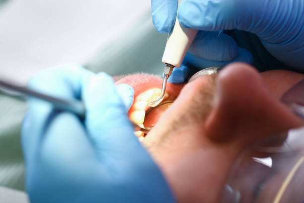 Best Broken or Chipped Tooth Repair in Helemano, HI